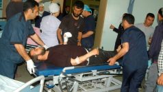 Zraněný muž, který byl převezen do nemocnice na jihu Turecka z bojů na syrsko-turecké hranici