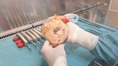 Srdce od zemřelého dárce není vhodné k transplantaci, ale i tak může posloužit kardiologickým pacientům