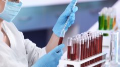 Laboratorní testy už dlouho pomáhají lékařům vyznat se v původcích nakažlivých onemocnění.